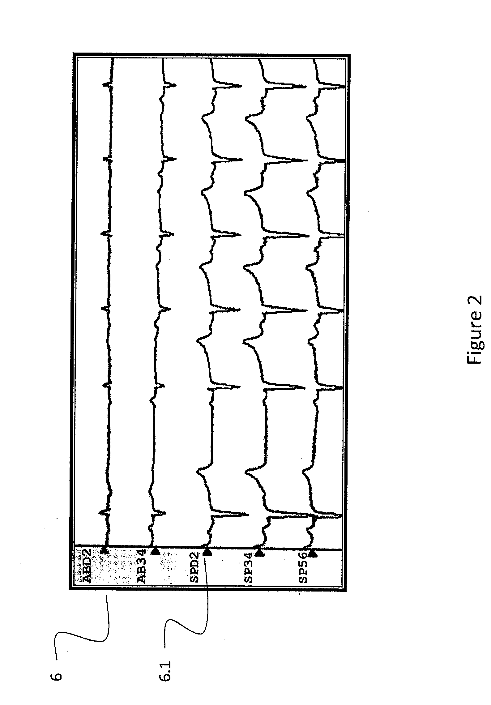 System and method for targeting catheter electrodes