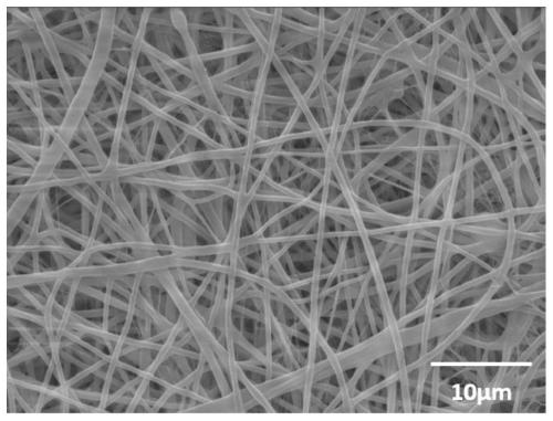 Waterproof, breathable, high-elastic and self-repairing double-layer nanofiber membrane for skin dressing and preparation method of nanofiber membrane