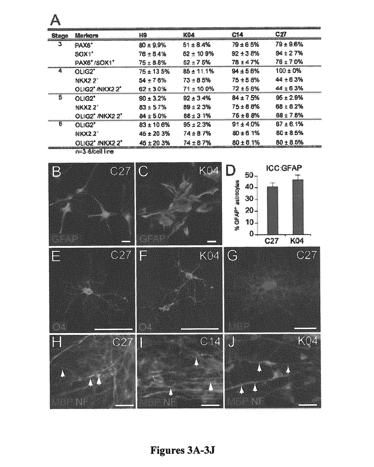 Induced pluripotent cell-derived oligodendrocyte progenitor cells for the treatment of myelin disorders