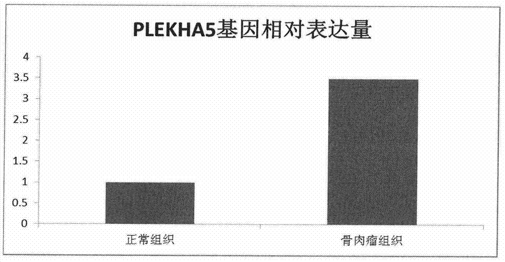 Application of PLEKHA5 in preparation of tumor diagnosis reagent