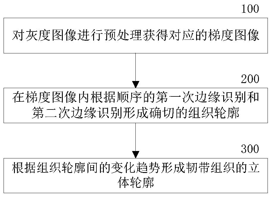 Method and system for separating ankle ligaments in medical image