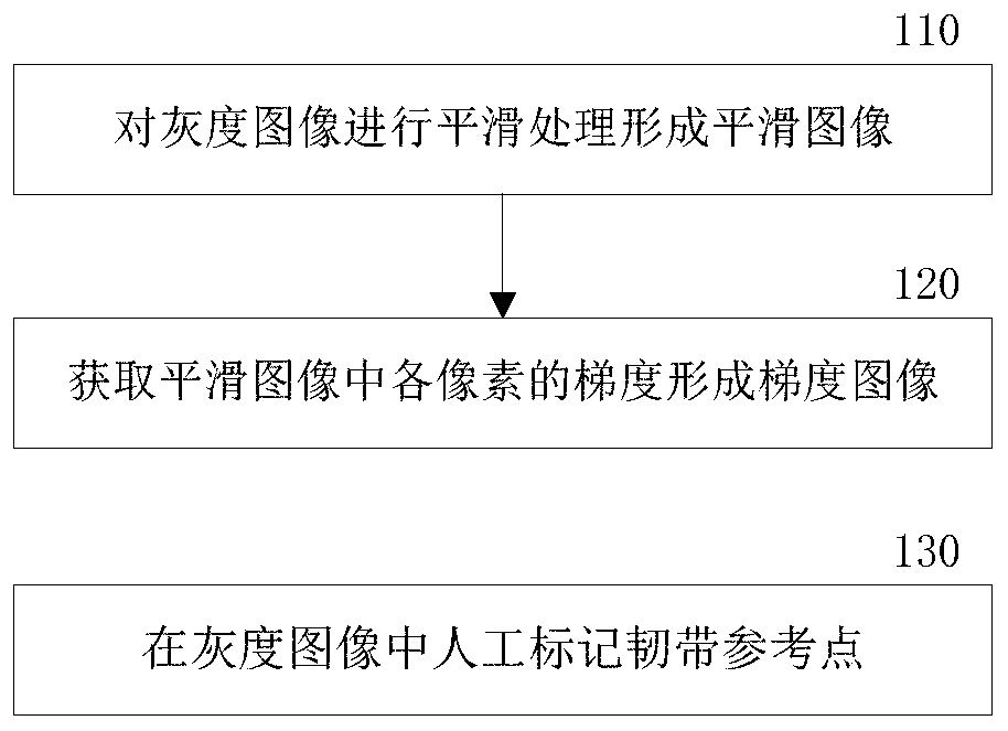 Method and system for separating ankle ligaments in medical image