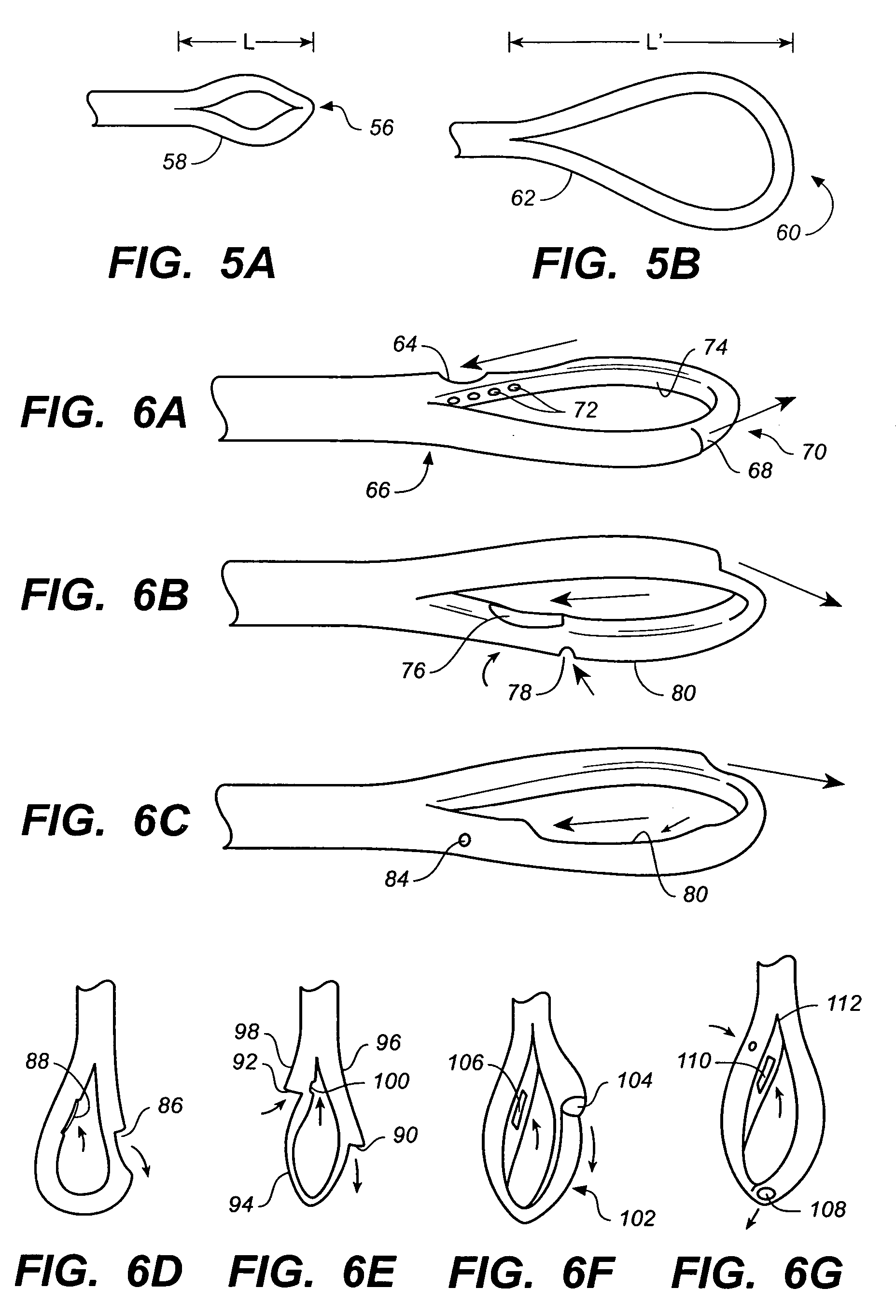 Loop-tip catheter