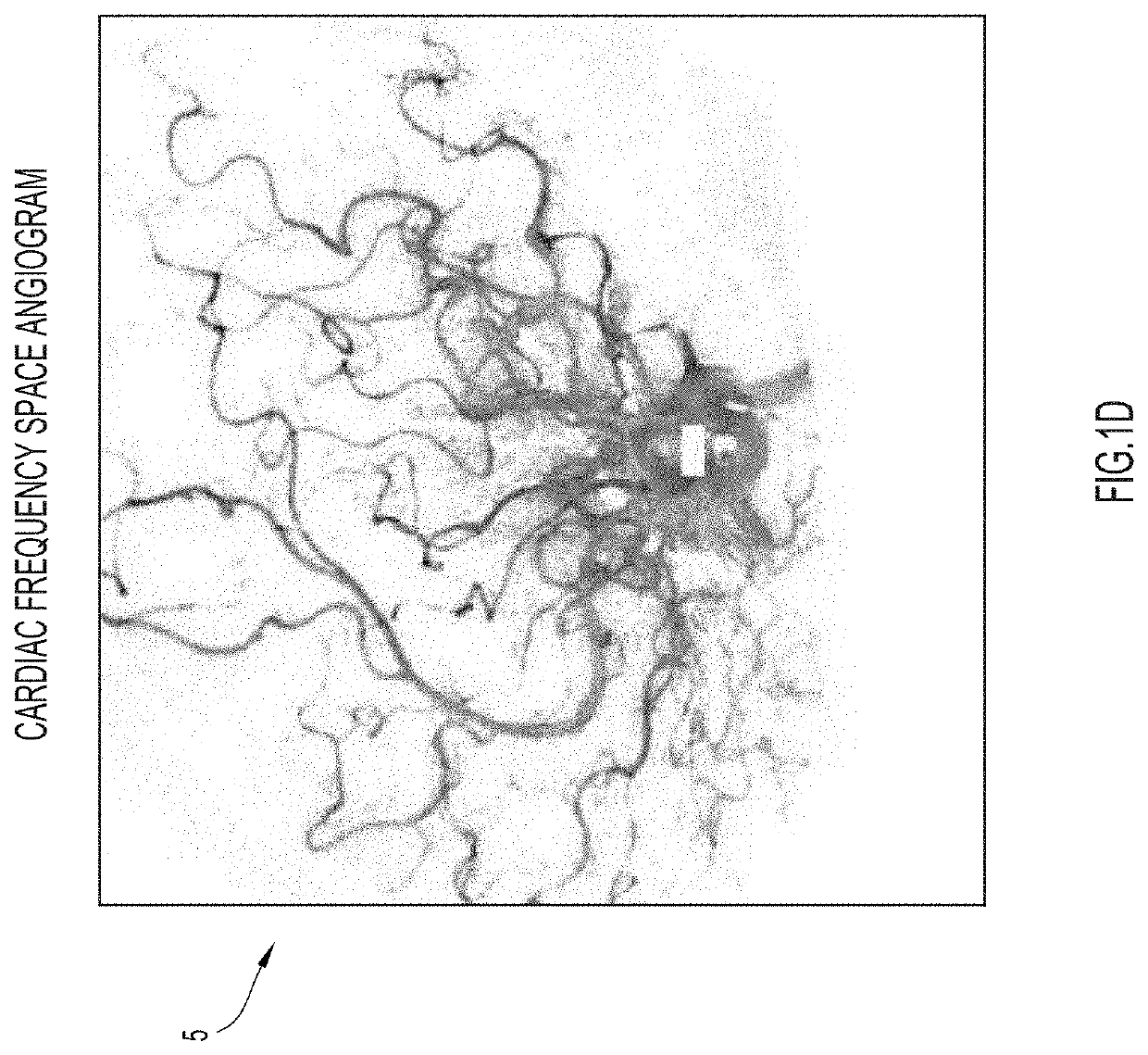 Spatiotemporal reconstruction in higher dimensions of a moving vascular pulse wave from a plurality of lower dimensional angiographic projections