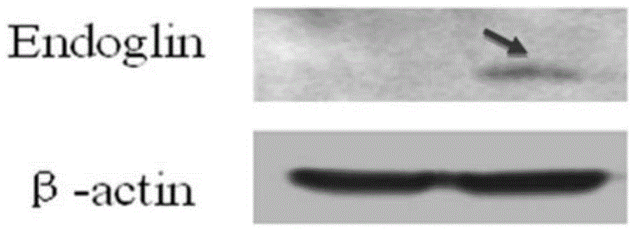 Cancer cell/DC fusion tumor vaccine for expressing Endoglin and preparation method for cancer cell/DC fusion tumor vaccine