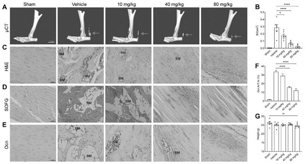 Application of medicine Galunissertib in preparation of medicine for preventing traumatic ectopic ossification