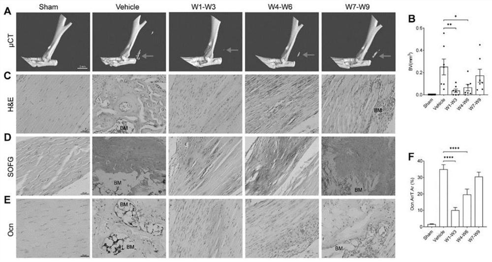 Application of medicine Galunissertib in preparation of medicine for preventing traumatic ectopic ossification