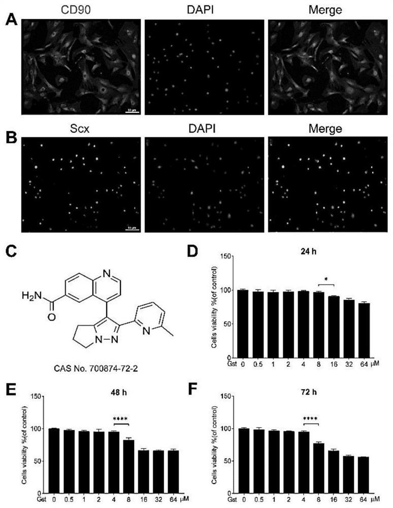 Application of medicine Galunissertib in preparation of medicine for preventing traumatic ectopic ossification