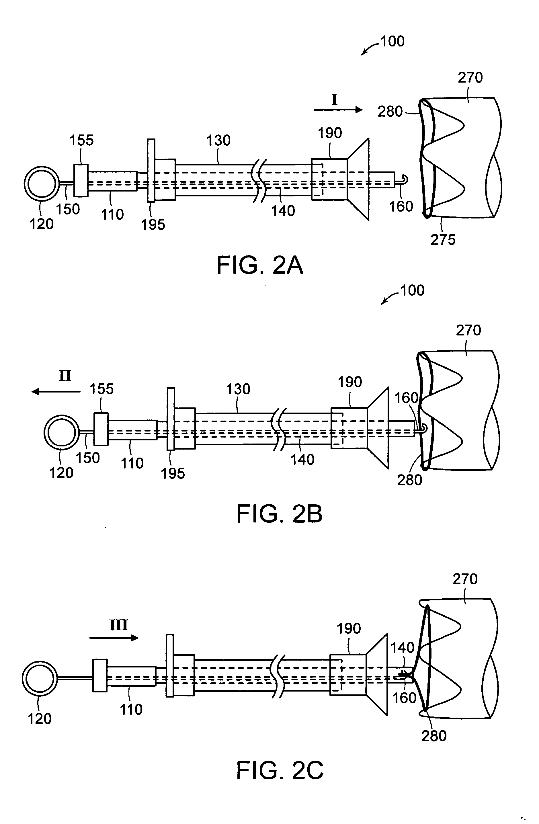 Removal and repositioning device