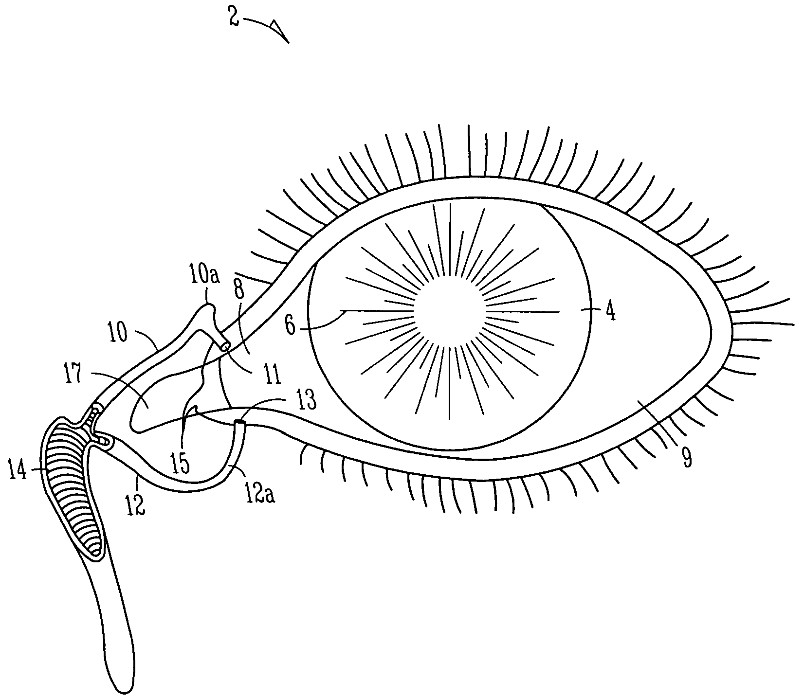 Insertion and extraction tools for lacrimal implants