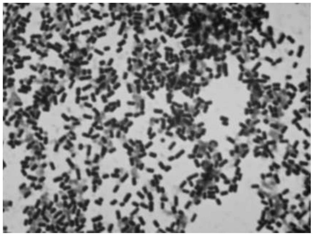 Lactobacillus ZJUIDS03 for antagonizing helicobacter pylori and application of lactobacillus ZJUIDS03