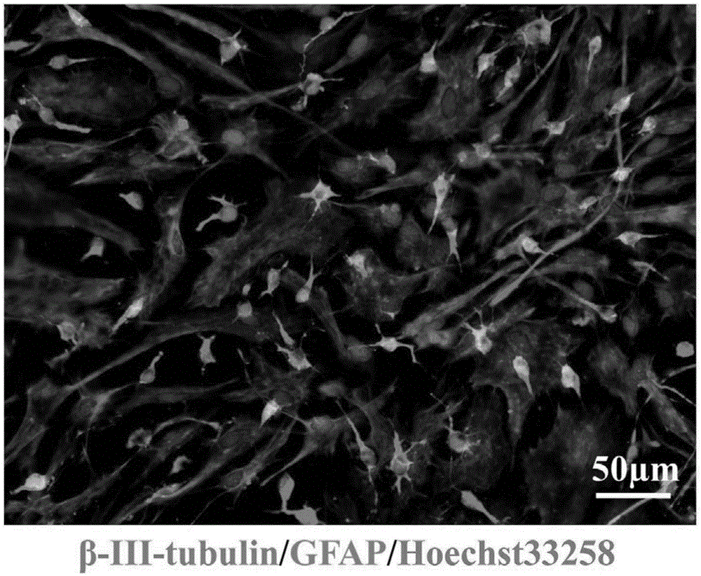 A kind of cryopreservation solution of neural stem cells and its application method