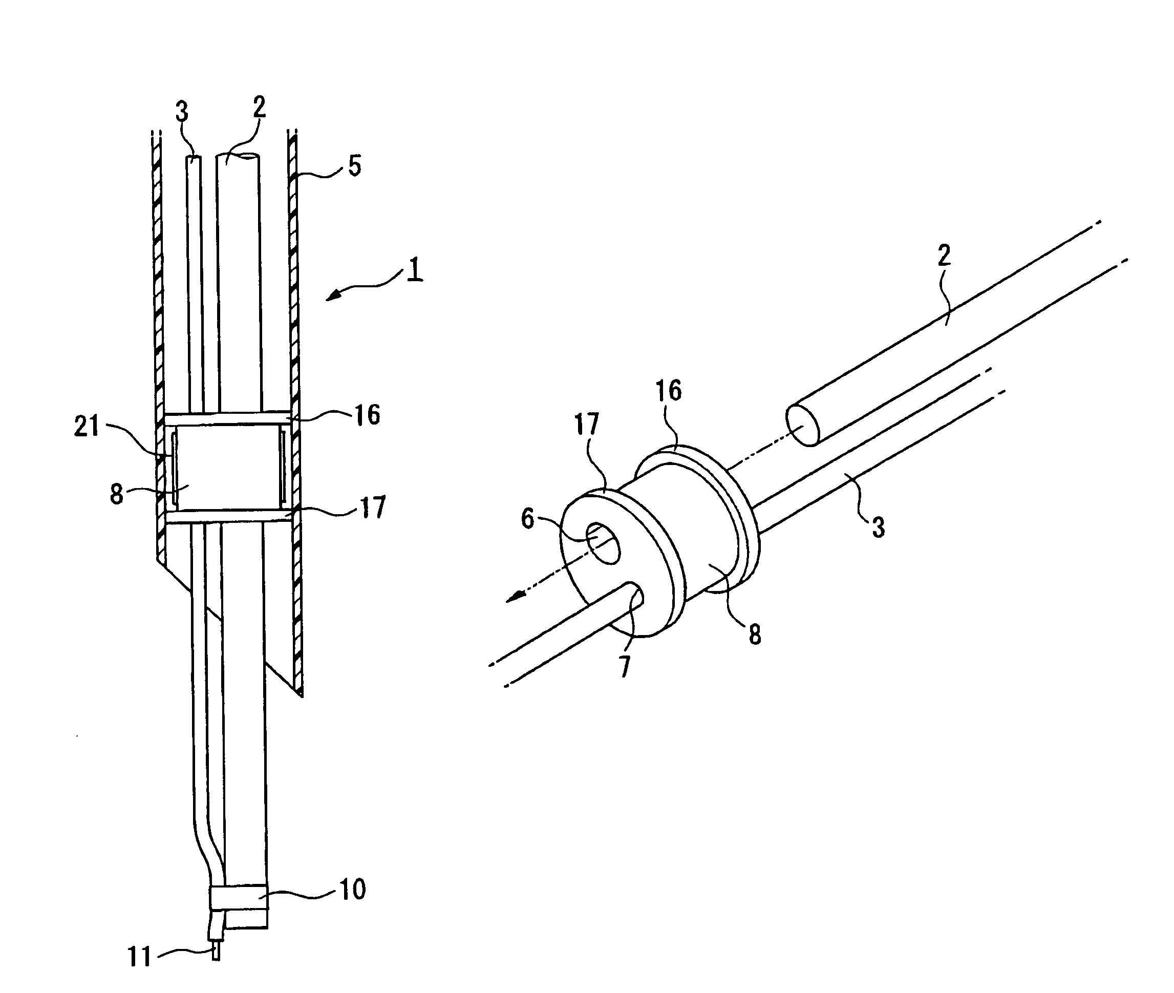 Insertion auxiliary implement