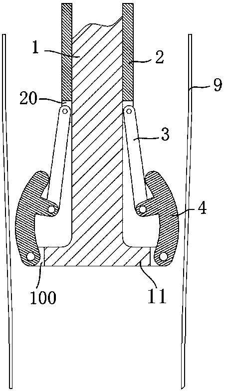 An esophagus-assisted peristaltic device