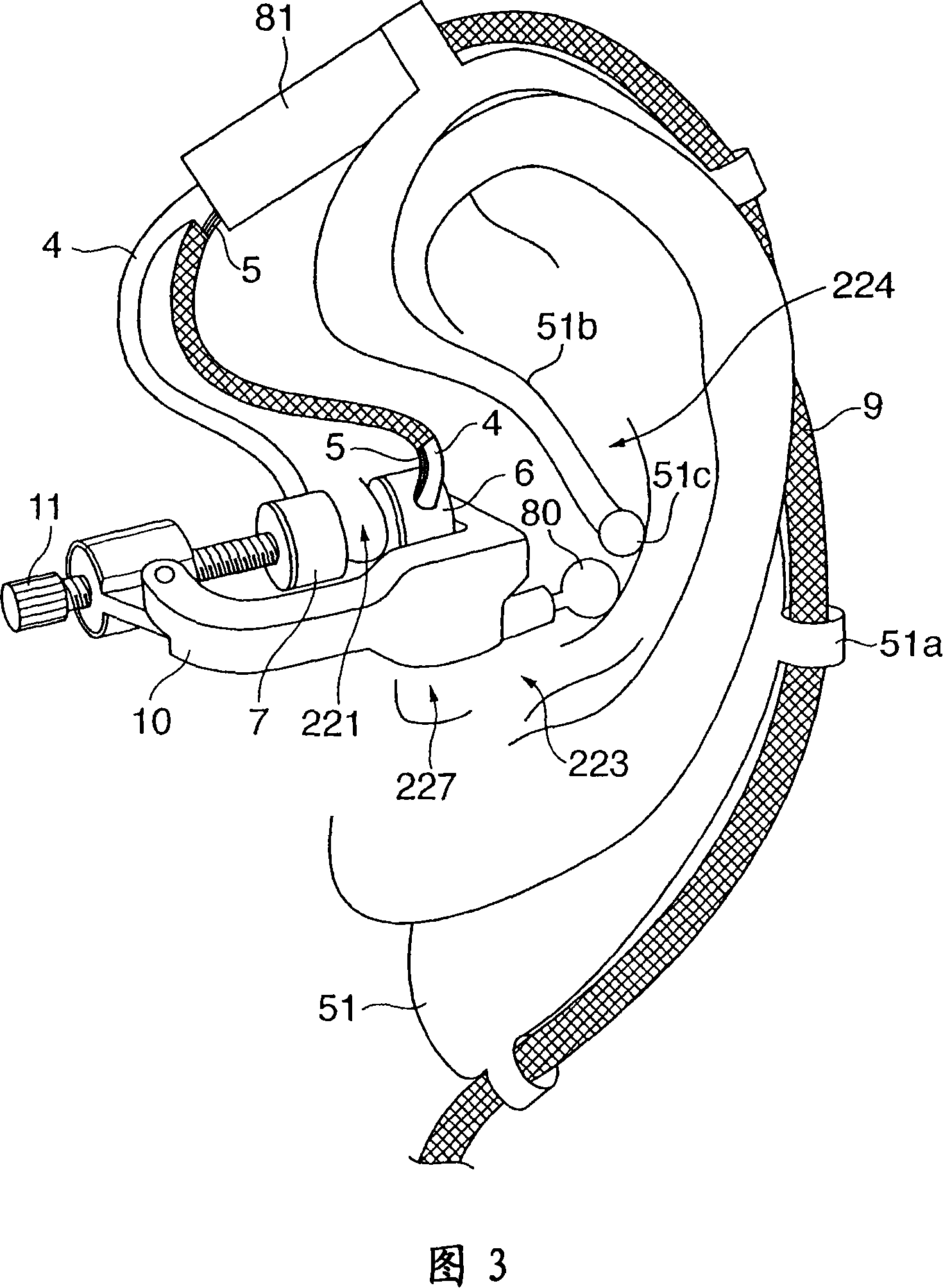 Blood pressure measuring apparatus