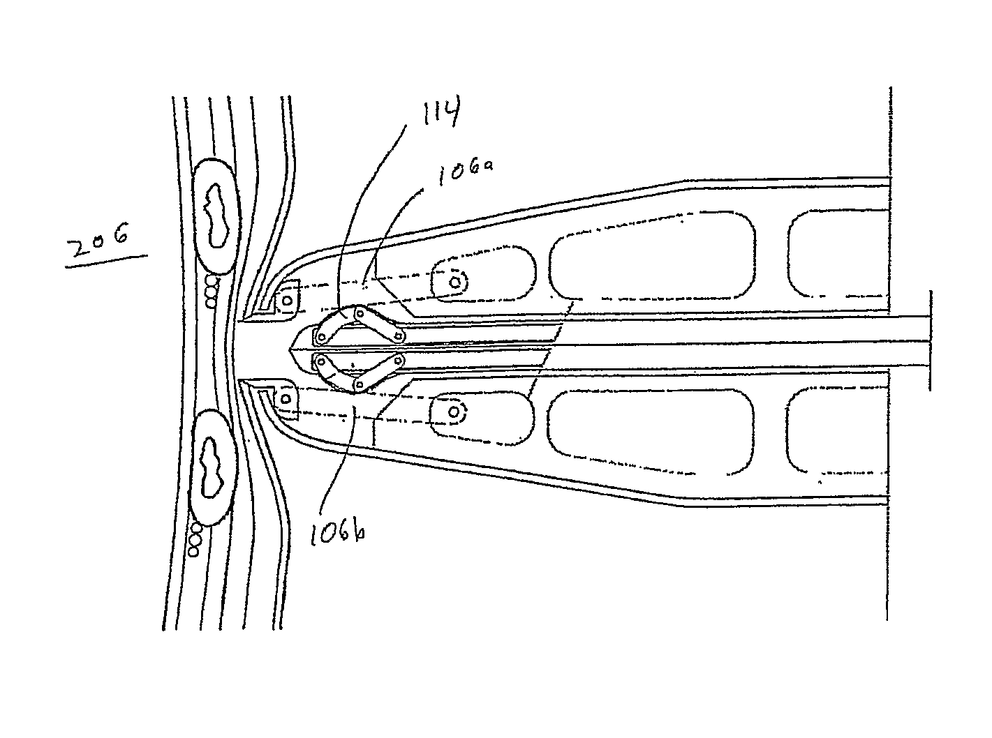 Chest drainage and apparatus for the insertion thereof