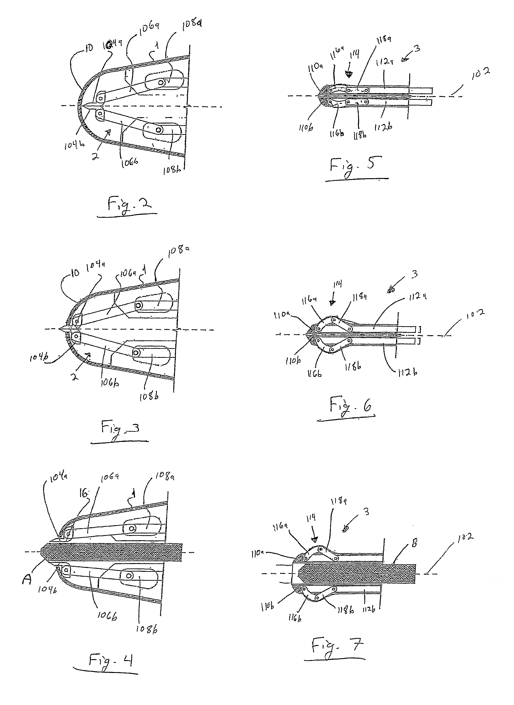 Chest drainage and apparatus for the insertion thereof