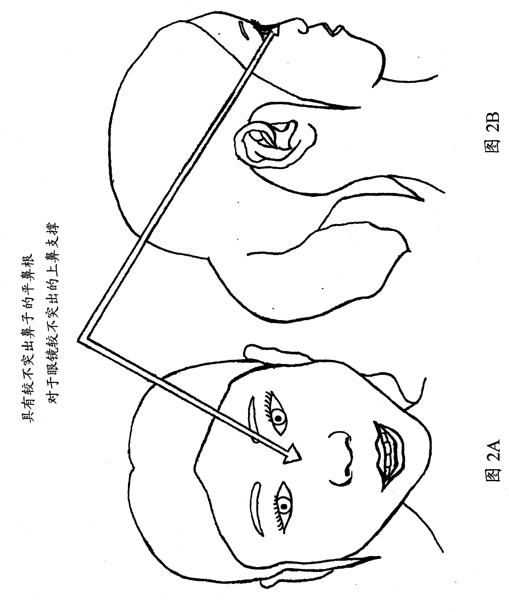 Spectacle assembly for faces without a prominent upper nasal support
