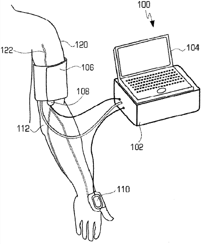 System and method of measuring changes in arterial volume of a limb segment