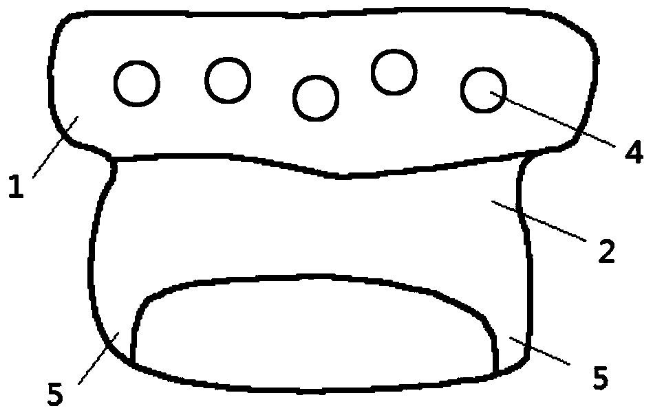 A Personalized Temporomandibular Joint Fossa Prosthesis