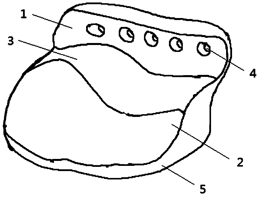 A Personalized Temporomandibular Joint Fossa Prosthesis