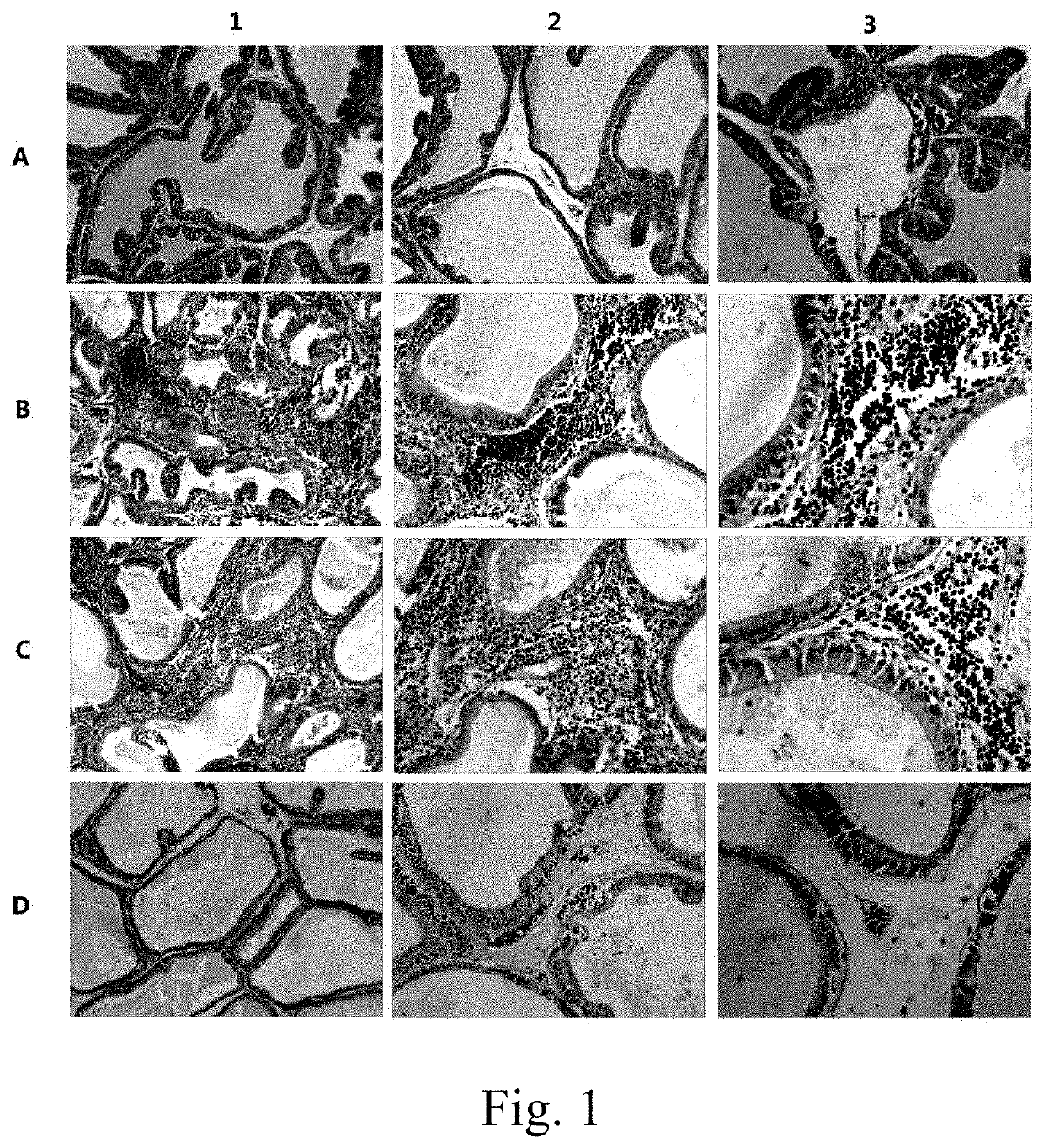 Application of TRPM8 protein, related peptide fragment and their antibodies