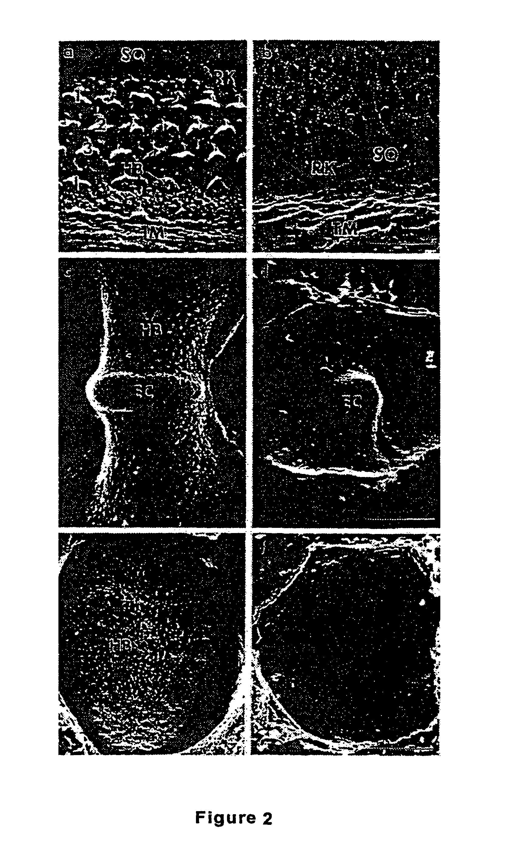 Compositions and methods for the therapeutic use of an atonal-associated sequence for deafness, osteoarthritis, and abnormal cell proliferation