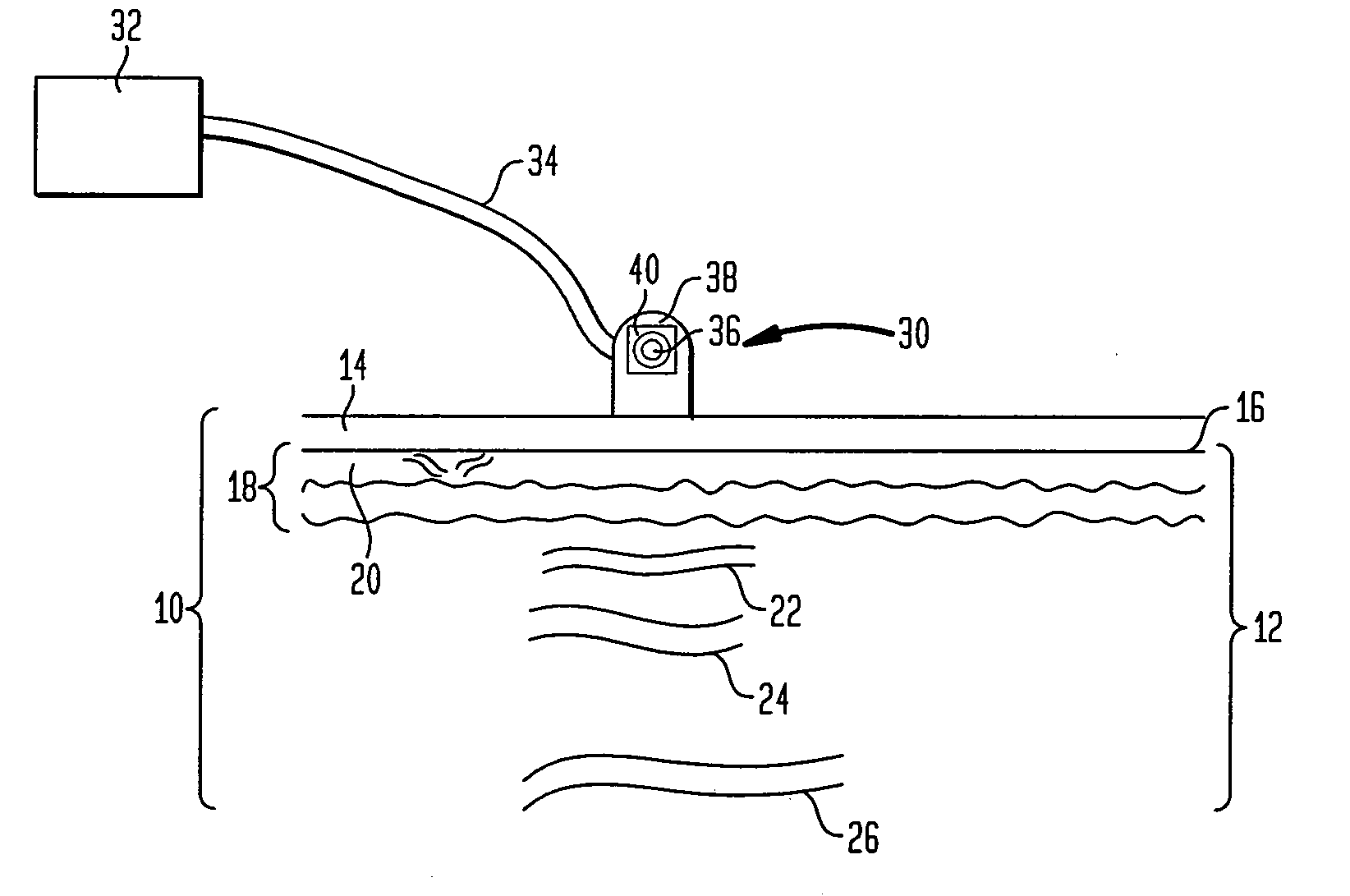 Method and apparatus for improved vascular related treatment