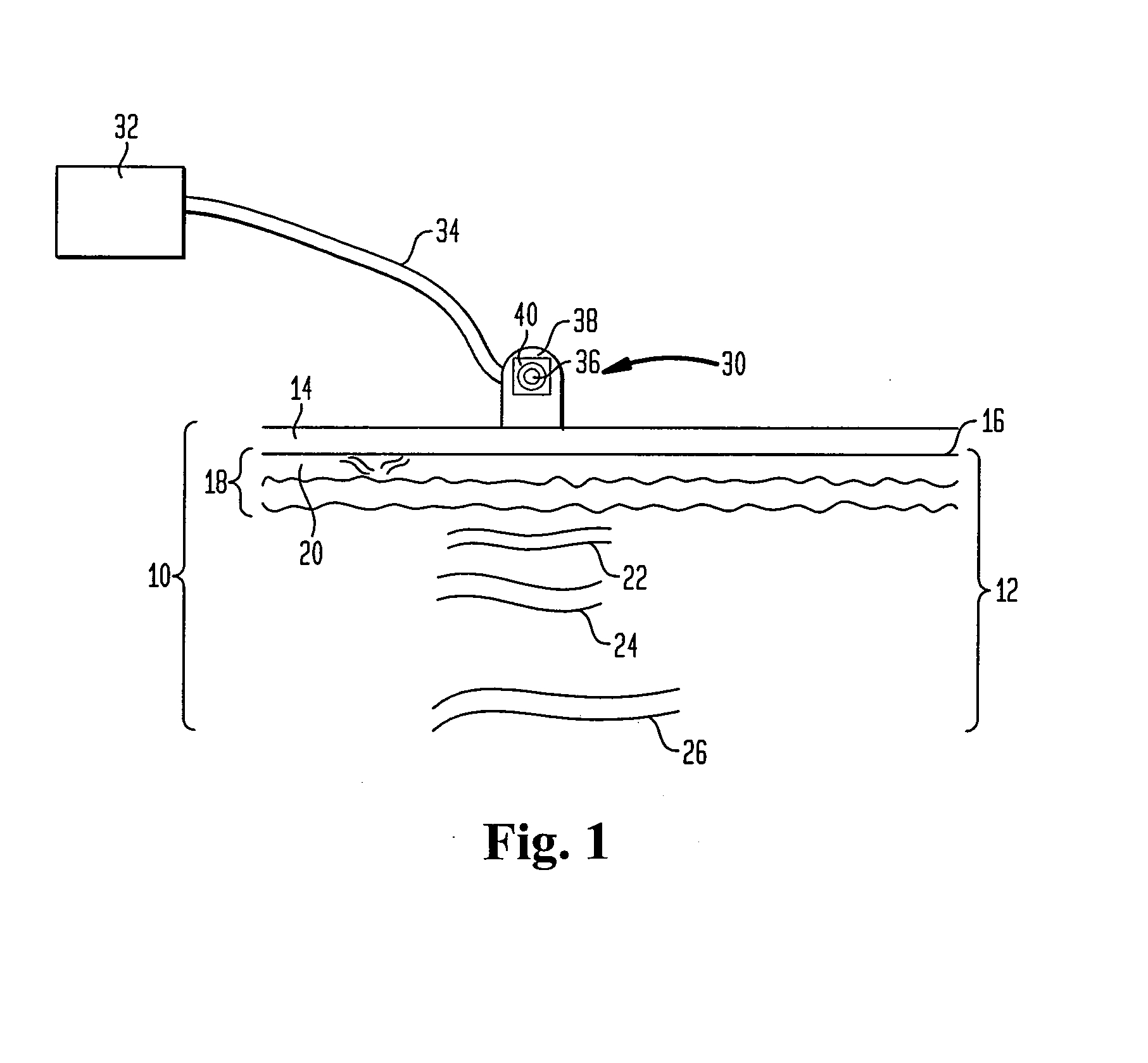 Method and apparatus for improved vascular related treatment
