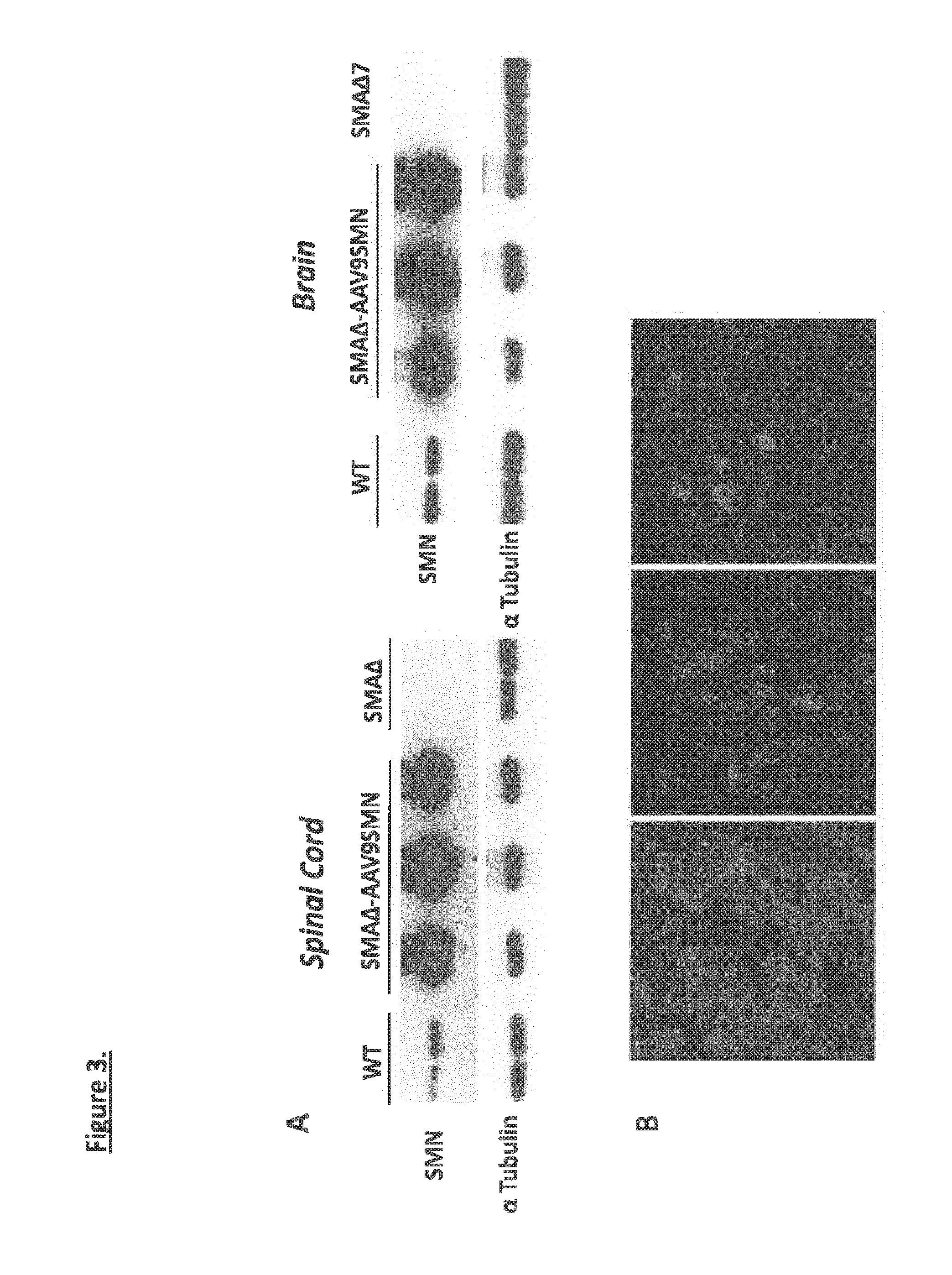 Widespread gene delivery of gene therapy vectors