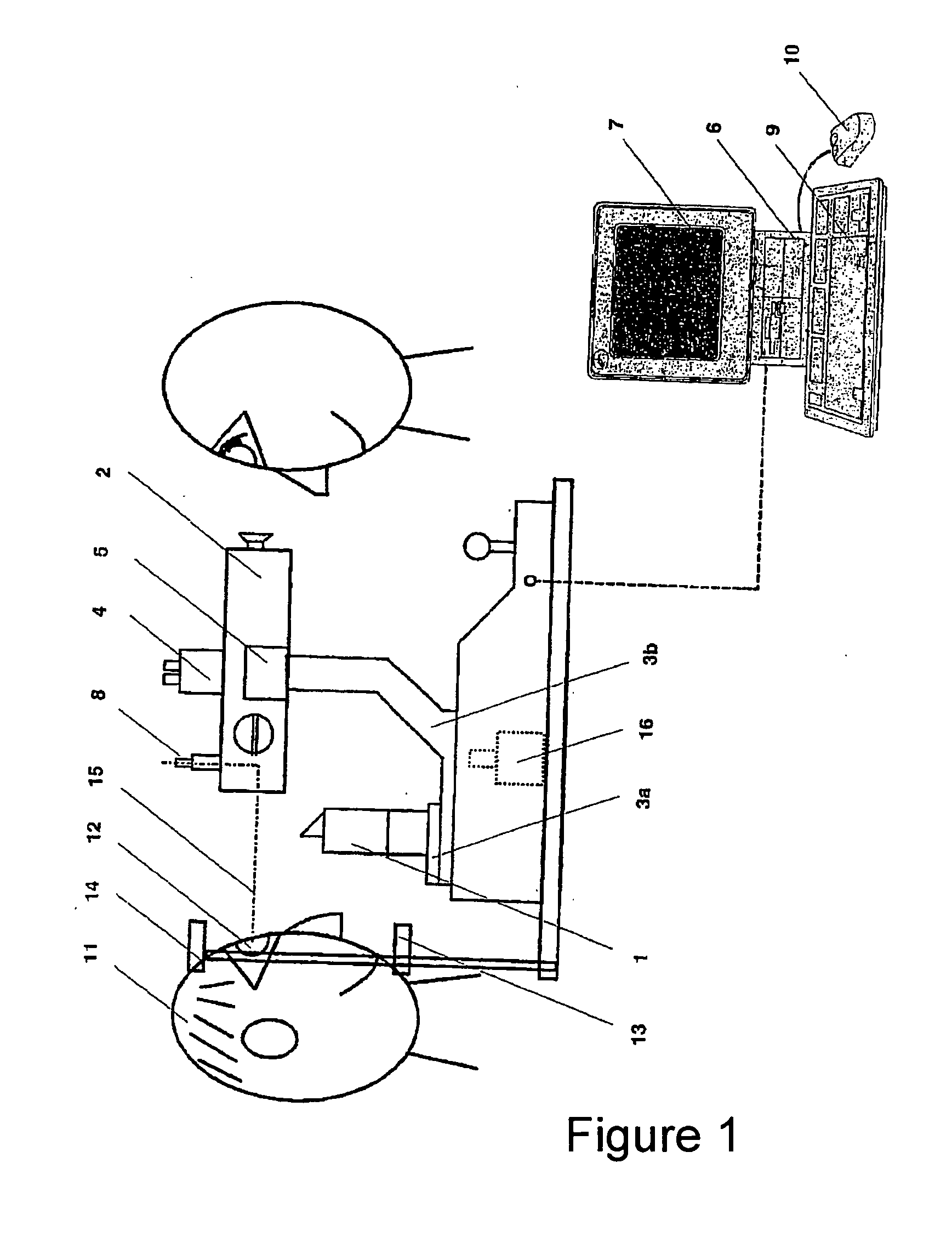 Ophthalmologic apparatus and related positioning method