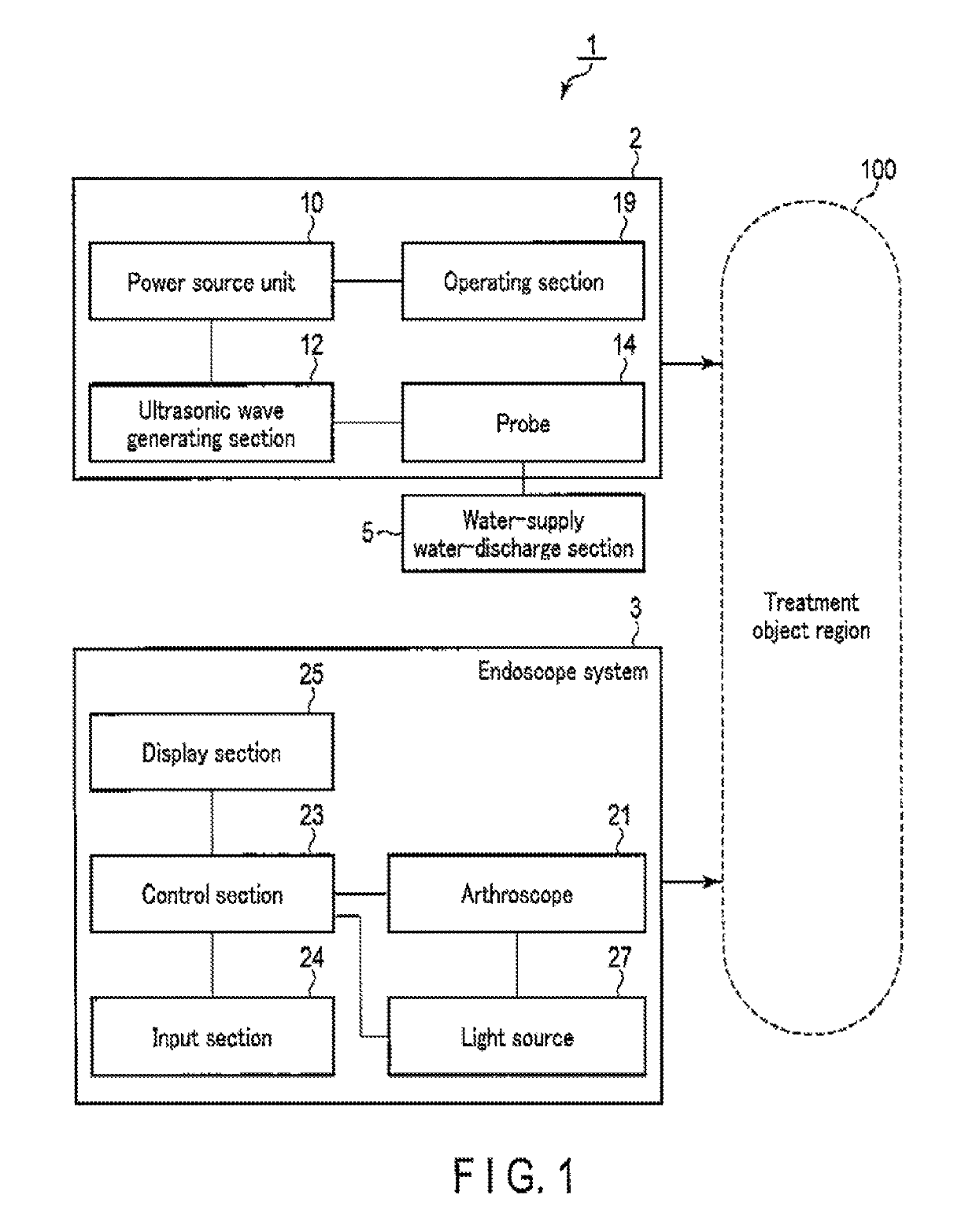 Method for replacement arthroplasty