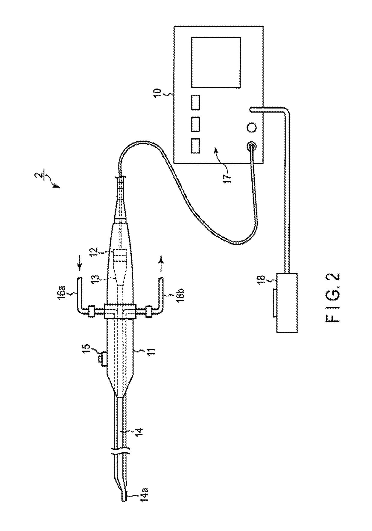 Method for replacement arthroplasty