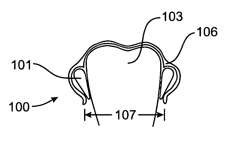 Systems and methods for improved engagement between aligners and teeth