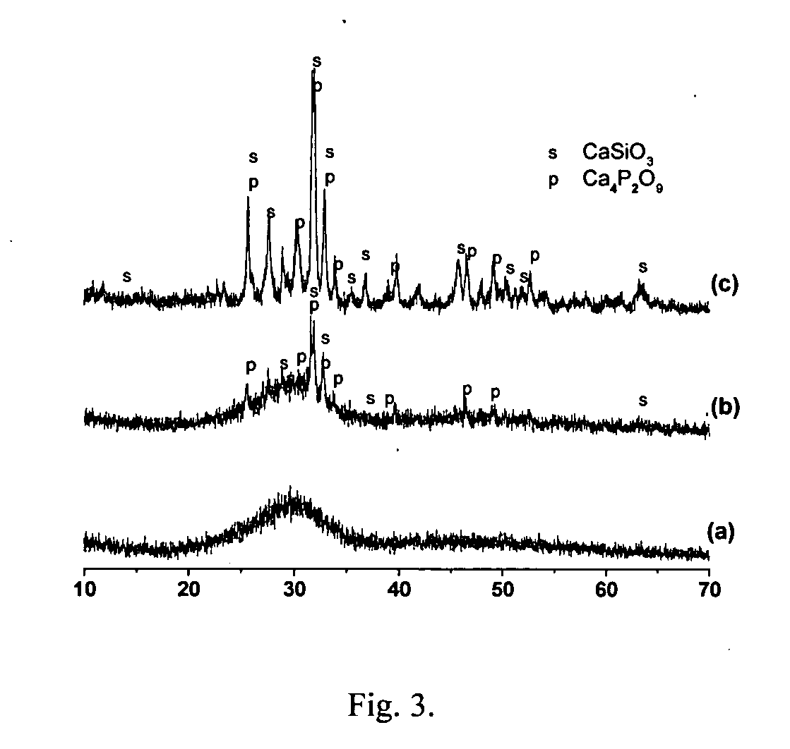 Resorbable macroporous bioactive glass scaffold and method of manufacture