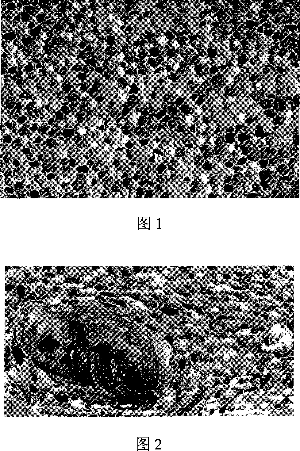 Method for producing bubble aluminum alloy special-shaped member with even pore structure