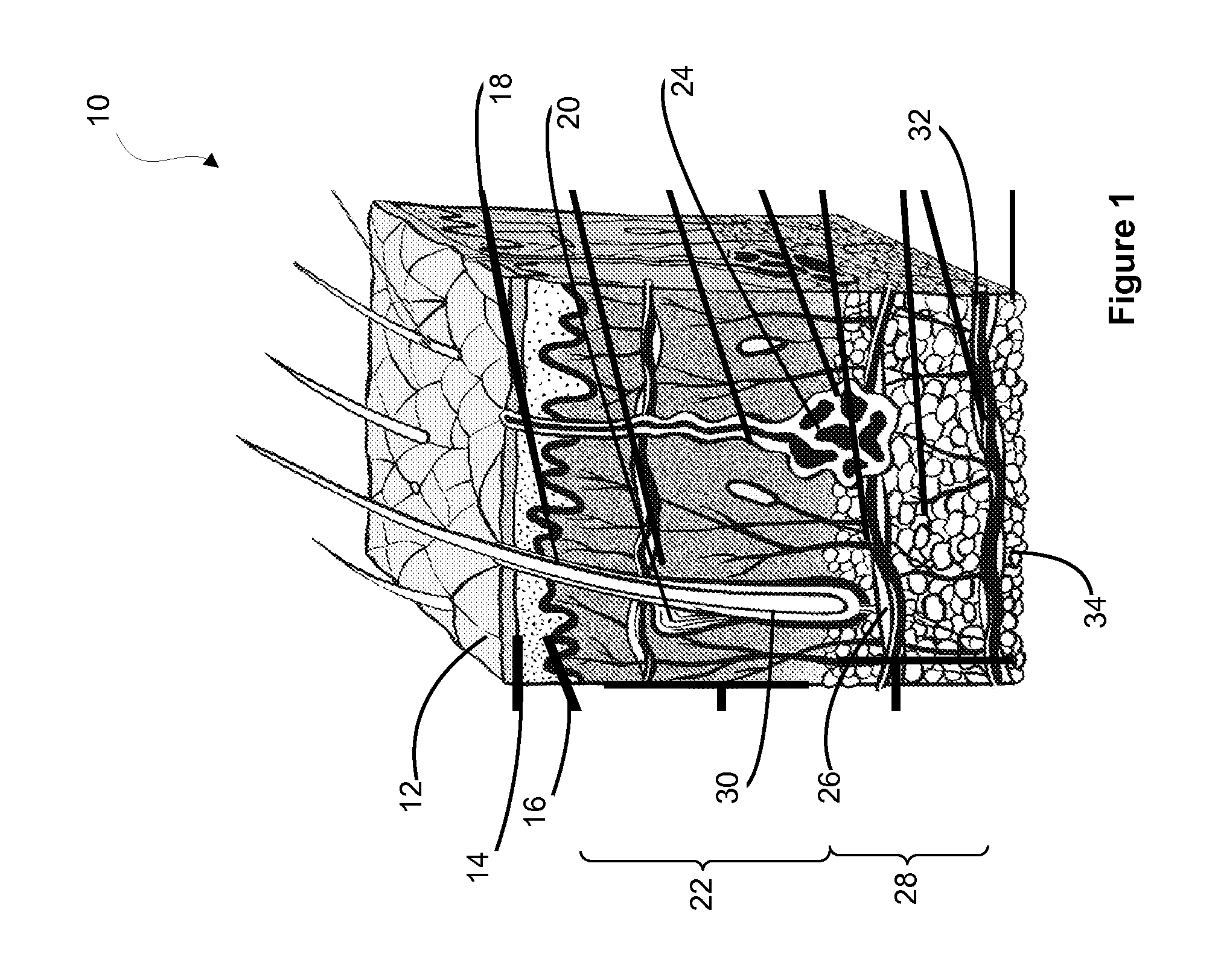 Systems and Methods for Enhancing the Delivery of Compounds to Skin Pores using Ultrasonic Waveforms