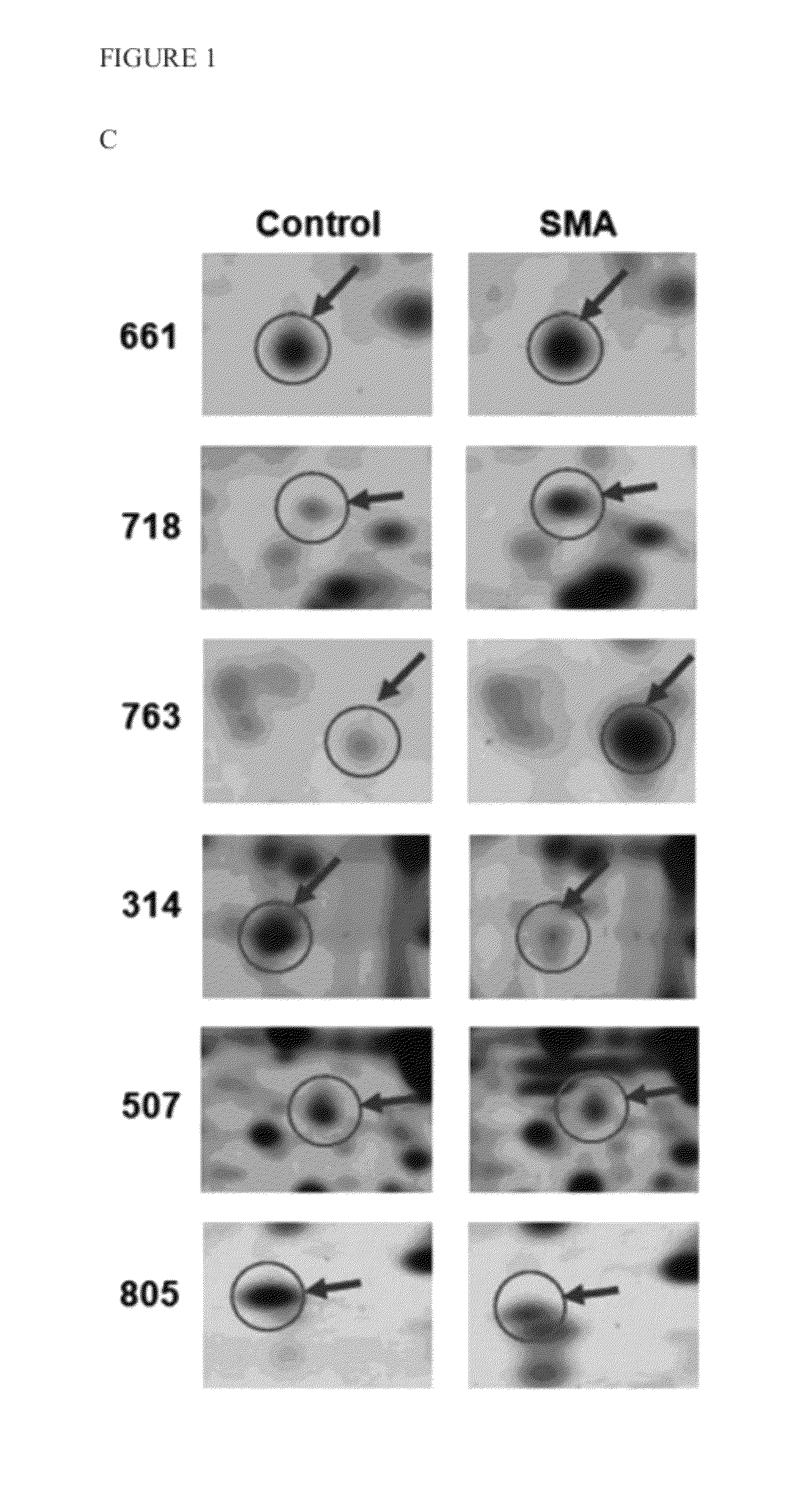 Method of regulating the expression level of survival of motor neuron 1