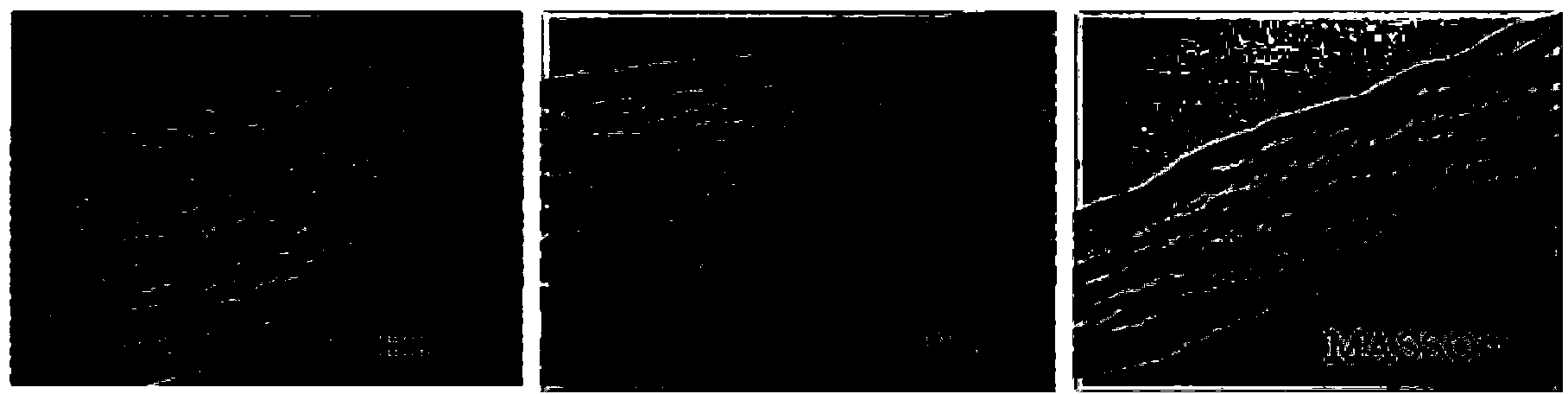 Acellular biological patch, preparation method and apparatus thereof