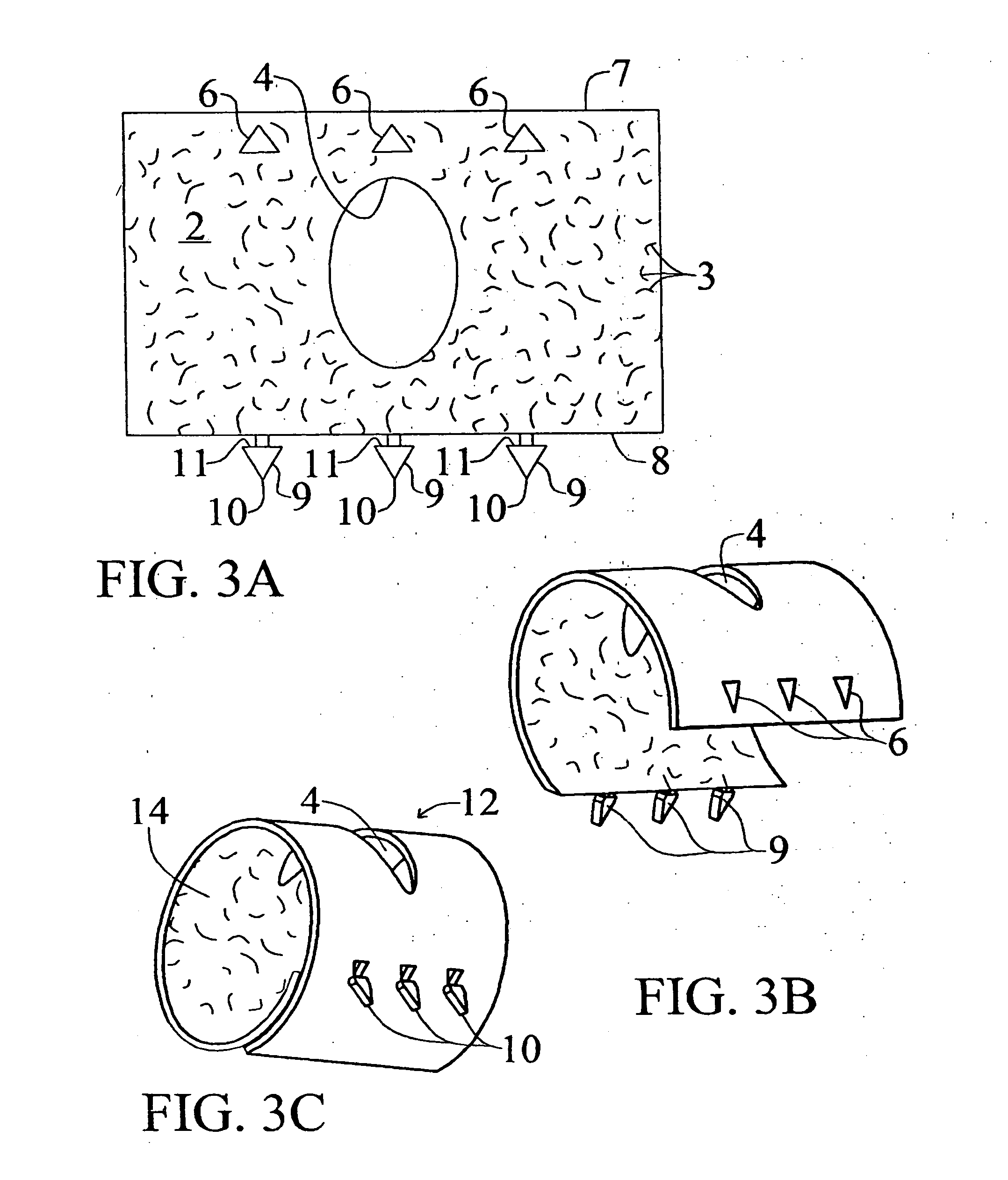 Medical implants and methods for regulating the tissue response to vascular closure devices