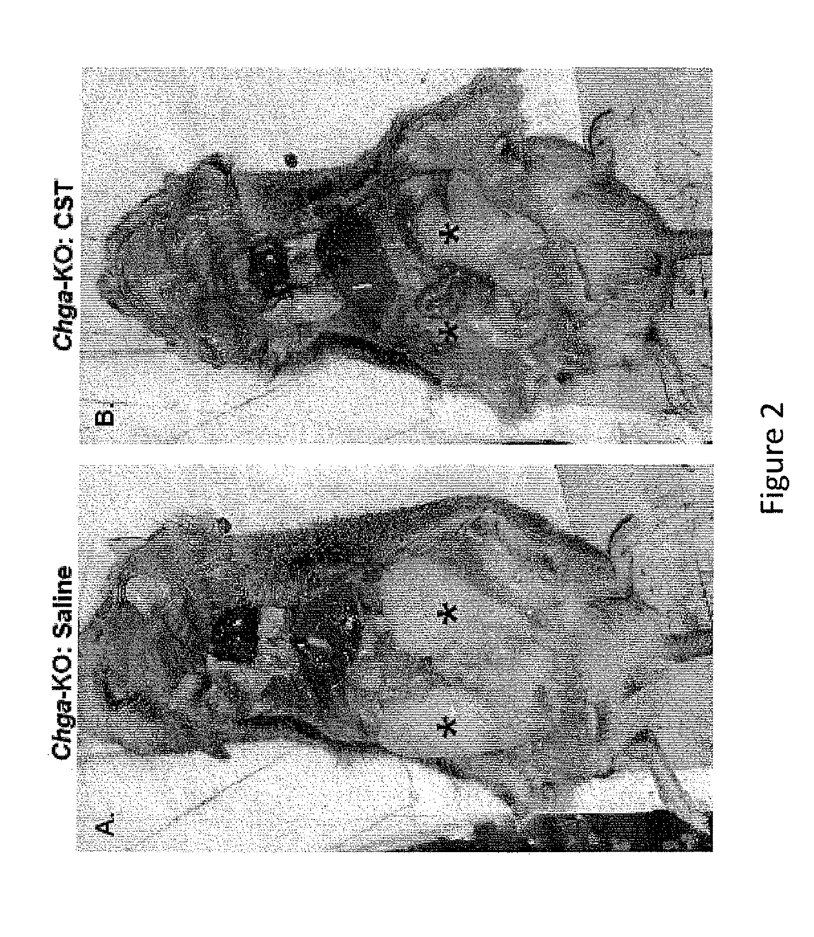 Methods for promoting lipolysis and oxidation in liver and adipose tissue using catestatin