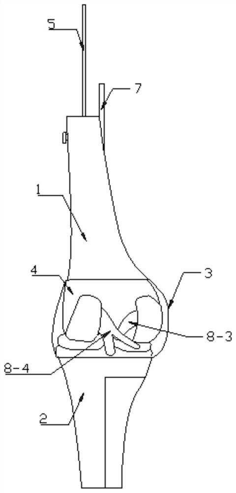 Knee joint model capable of demonstrating pressure change in knee joint cavity in KOAPT movement