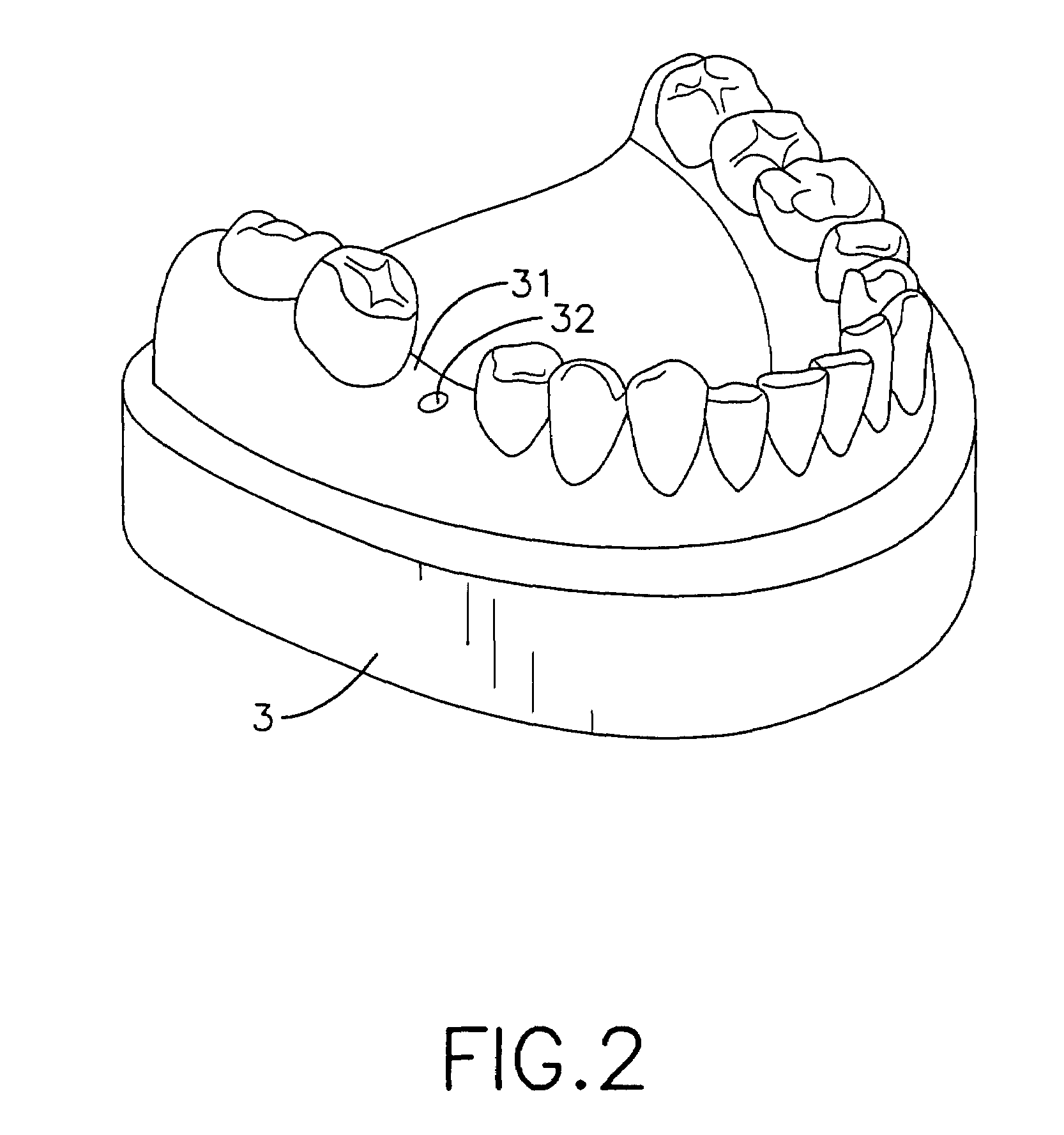 Positioning device for dental implant