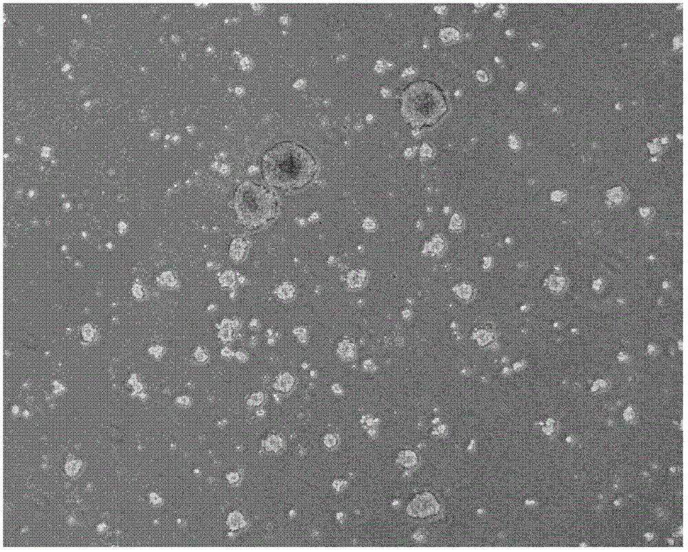 A method for isolating and culturing human meningioma cells