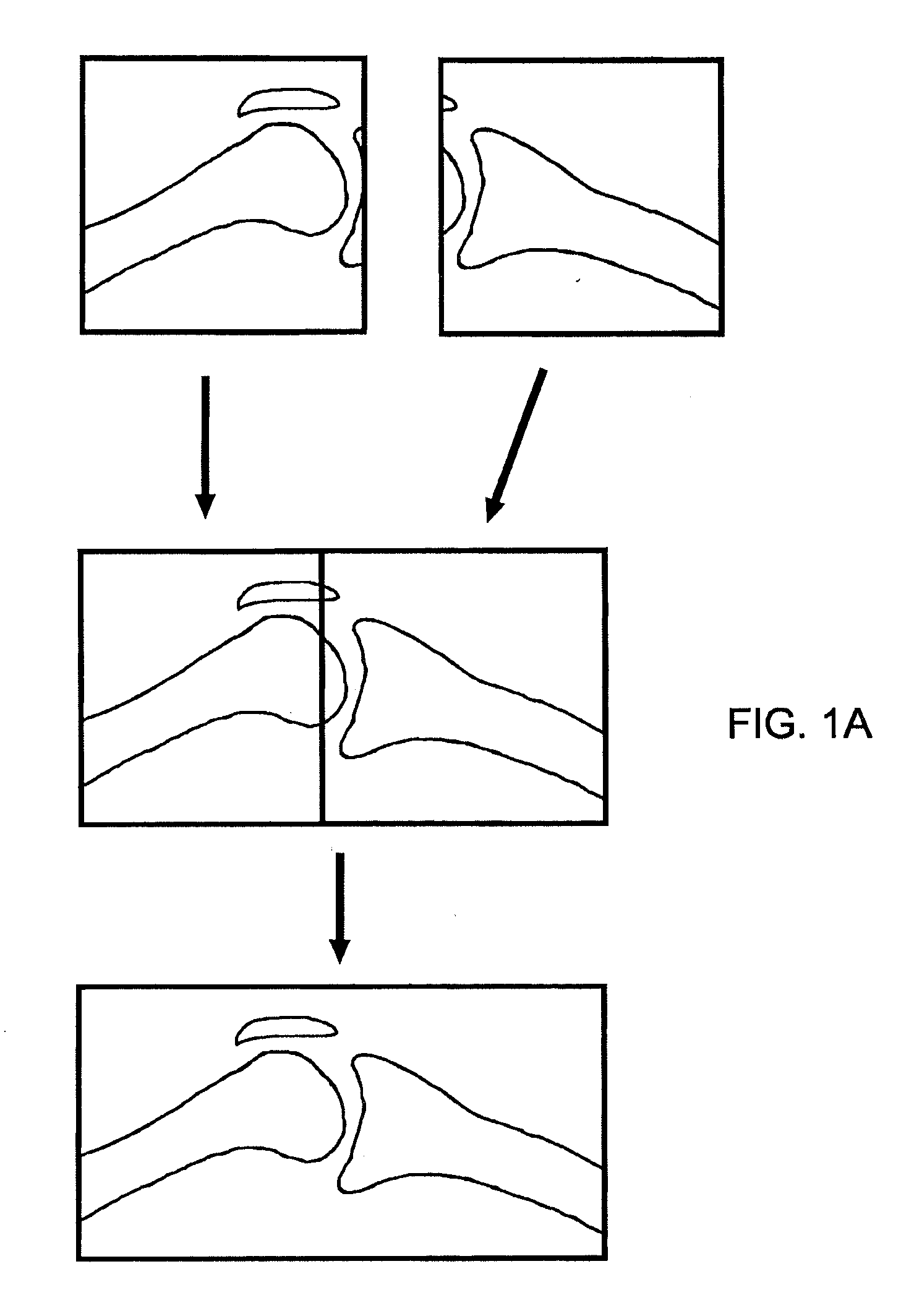 Image stitching and related method therefor