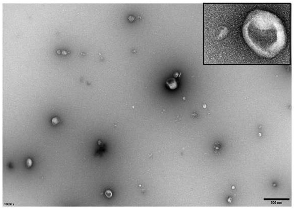 Myeloblastoma cell exosome capable of inducing polarization of M2-like TAMs