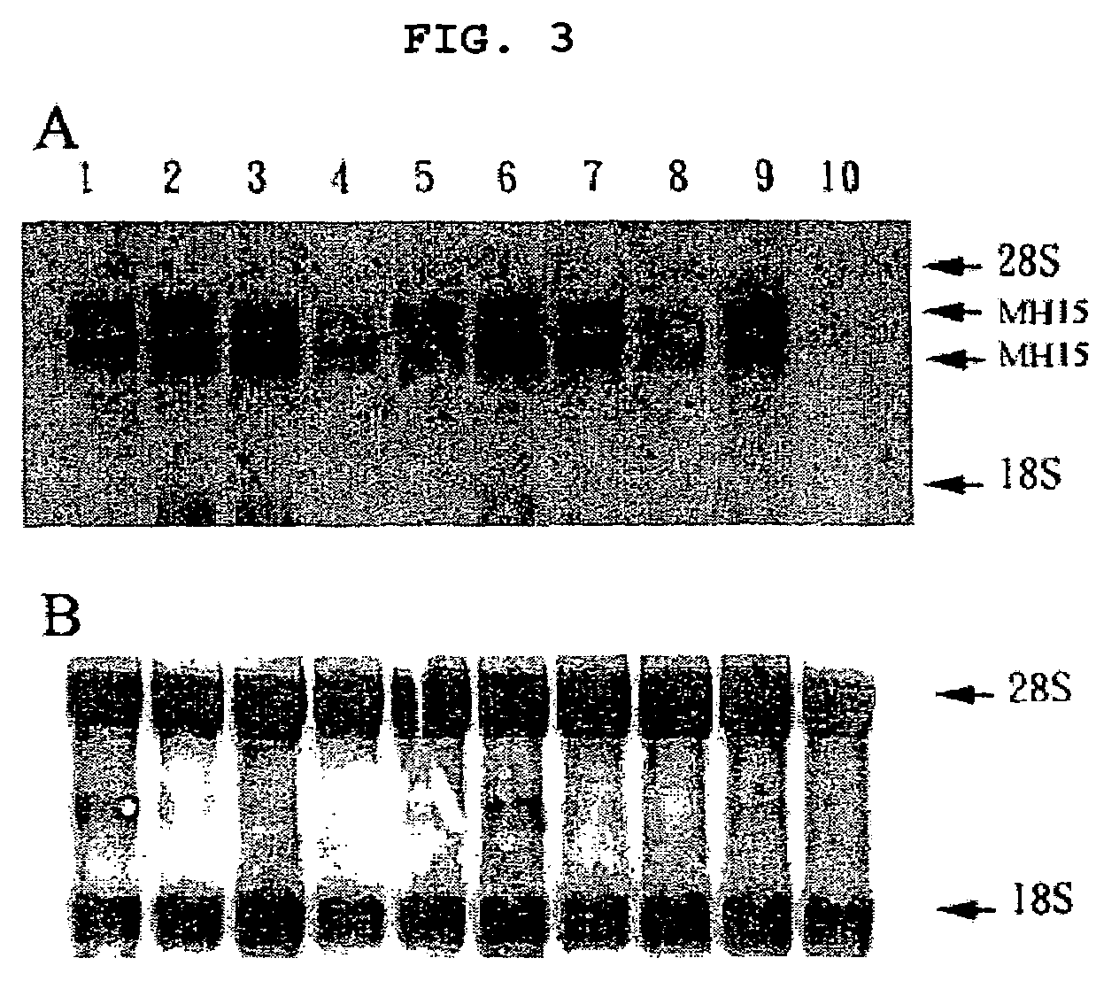 Cancer specific gene MH15