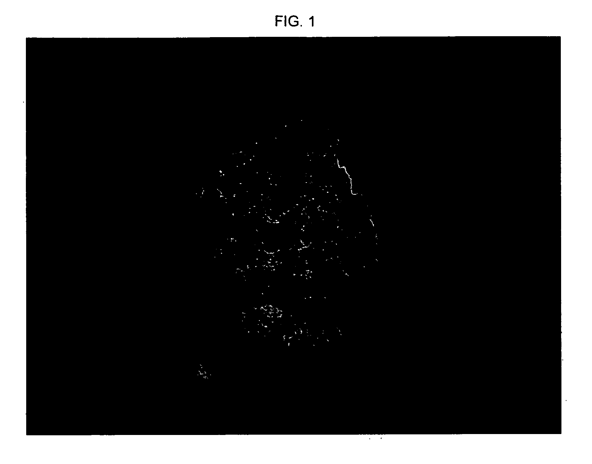 Porous beta-tricalcium phosphate and methods for producing the same