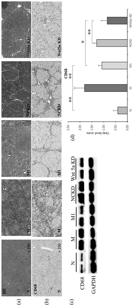 Wnt5a-knock-down M1 type bone marrow-derived macrophage for treating hepatic fibrosis and liver cirrhosis and application of M1 type bone marrow-derived macrophage