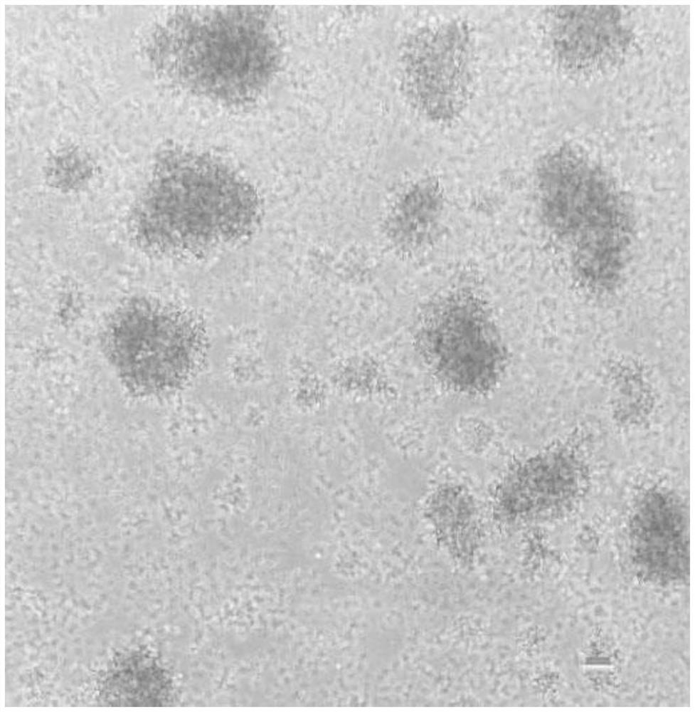 An in vitro activation method of cytokine-induced killer cells